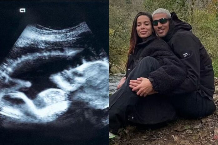 anitta-publica-imagem-de-ultrassom-e-diverte-fas:-“ele-nao-e-lindo?”