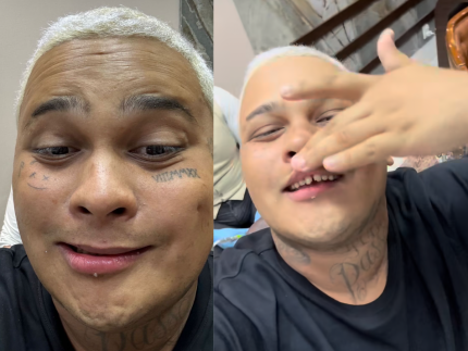 mc-ryan-surpreende-ao-aparecer-sem-facetas-e-mostrar-a-realidade-dos-dentes