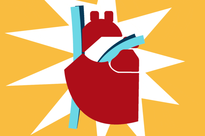 vida-apos-o-infarto:-o-que-acontece-depois-de-um-ataque-cardiaco