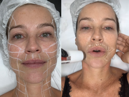 luana-piovani-passa-por-procedimentos-esteticos-e-diz:-“verao-e-solteira”