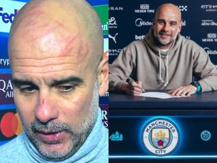 guardiola-deixa-machucados-na-cabeca-apos-empate-na-champions-league;-veja