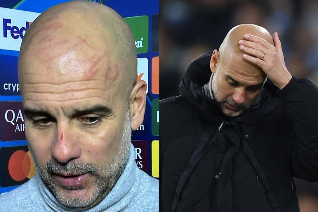 guardiola-se-pronuncia-sobre-machucados-no-rosto-e-cita-saude-mental