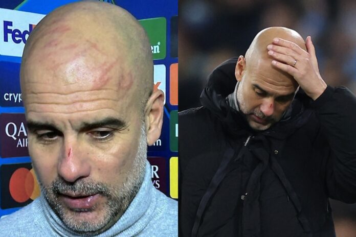 guardiola-se-pronuncia-sobre-machucados-no-rosto-e-cita-saude-mental