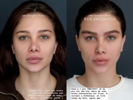 flavia-pavanelli-realiza-transplante-de-sobrancelha-e-divide-opinioes