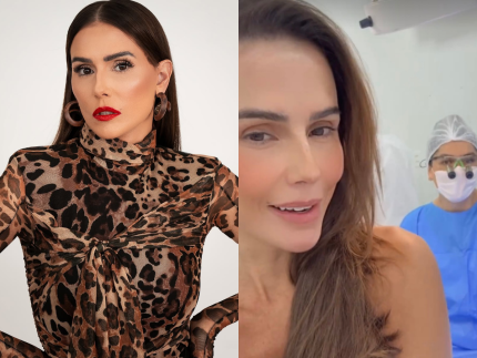 deborah-secco-faz-cirurgia-de-transplante-de-sobrancelhas:-“animada”