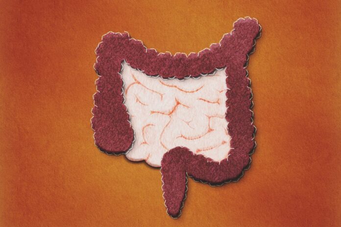 cancer-de-intestino:-conheca-sintomas-e-por-que-fazer-exame-preventivo