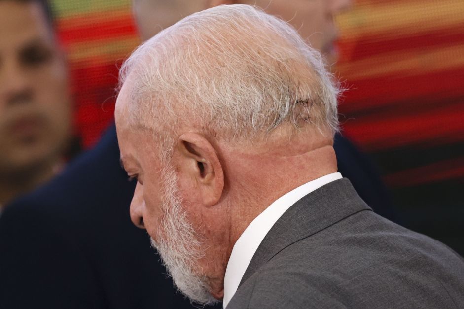lula-passa-por-cirurgia-em-sao-paulo-apos-dores-de-cabeca