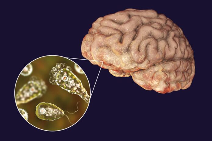 “comedora-de-cerebro”:-saiba-sobre-ameba-que-causou-morte-no-ce