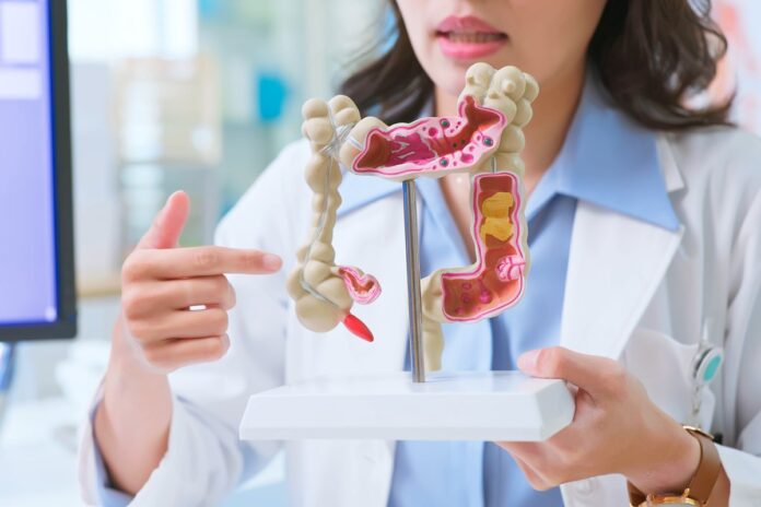 saiba-quais-sao-os-sinais-mais-incomuns-do-cancer-de-intestino