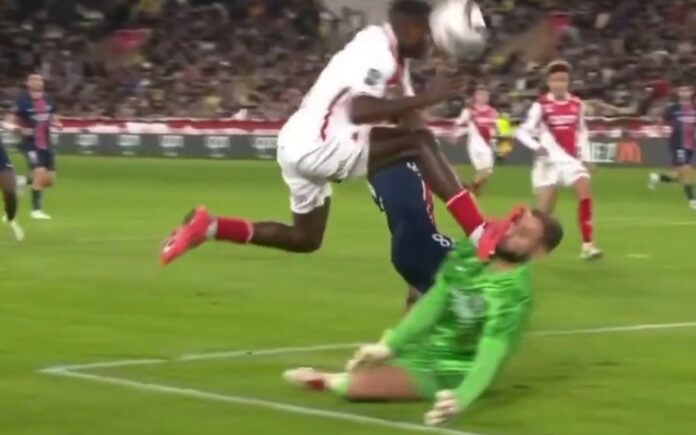 goleiro-do-psg-leva-pisao-no-rosto-e-fica-com-cicatriz-enorme;-veja
