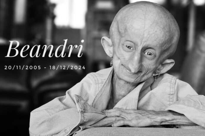 morre-beandri-booysen,-influenciadora-com-doenca-rara,-aos-19-anos