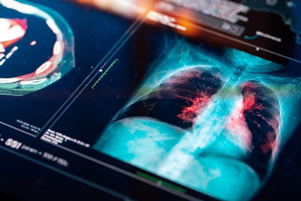 cancer:-confira-os-tratamentos-que-mais-avancaram-em-2024