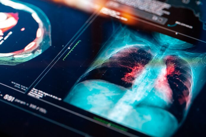 cancer:-confira-os-tratamentos-que-mais-avancaram-em-2024
