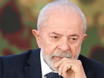 lula-faz-novos-exames-de-imagem-na-cabeca-e-segue-melhorando,-diz-boletim
