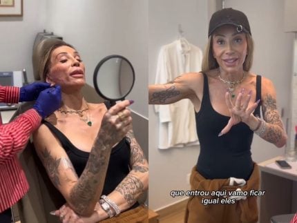 com-transformador-de-pele,-maya-massafera-ultrapassa-30-procedimentos-esteticos