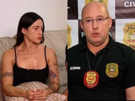 apos-pericia-em-apartamento,-delegado-se-pronuncia-sobre-caso-de-queimadura-por-fogos