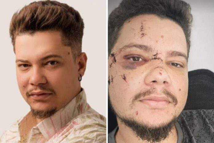sertanejo-benicio-e-agredido-com-garrafada-apos-show-e-enfrenta-recuperacao-dificil