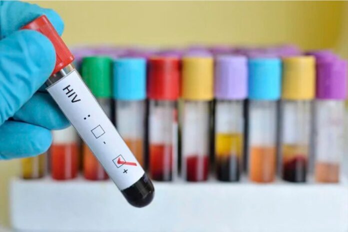 mudancas-climaticas-sao-associadas-a-pior-prevencao-do-hiv,-diz-estudo