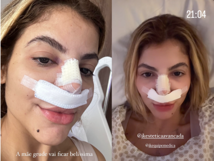 ex-bbb-hariany-mostra-resultado-de-cirurgias-plasticas.-confira!