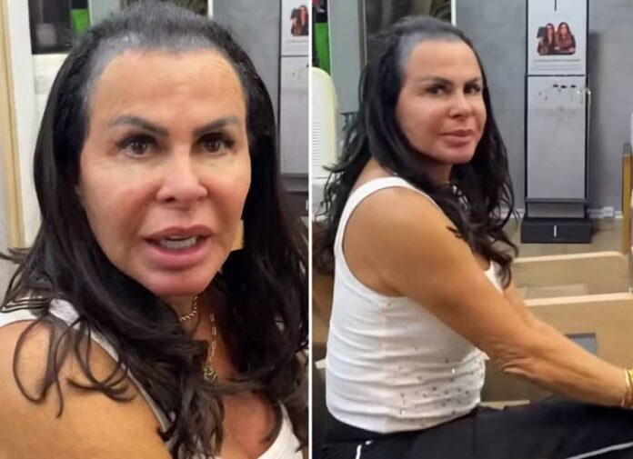 video:-gretchen-mostra-calvicie-antes-de-realizar-aplicacao-no-cabelo