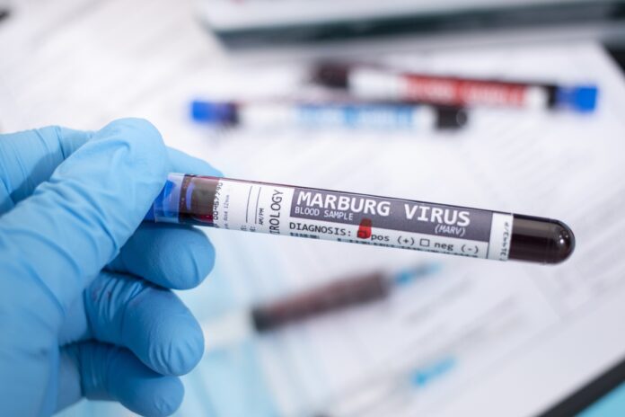 tanzania-confirma-surto-de-virus-marburg,-altamente-letal