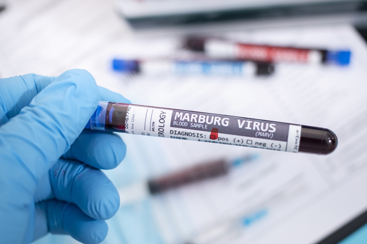 tanzania-confirma-surto-de-virus-marburg,-altamente-letal