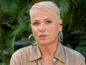 especialista-explica-procedimento-realizado-por-xuxa-meneghel-no-joelho