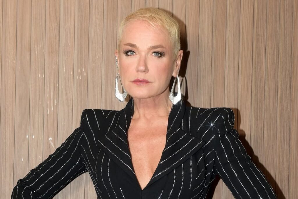 xuxa-tem-alta-apos-passar-por-cirurgia-no-joelho