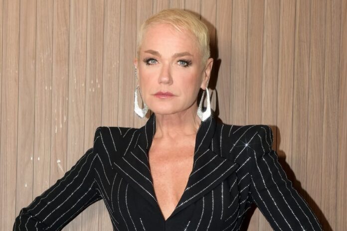 xuxa-tem-alta-apos-passar-por-cirurgia-no-joelho