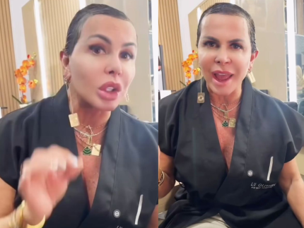 gretchen-posa-sem-mega-hair-e-mostra-realidade-de-sua-alopecia