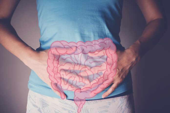 cancer-de-intestino:-anti-inflamatorio-pode-reduzir-risco-de-recidiva