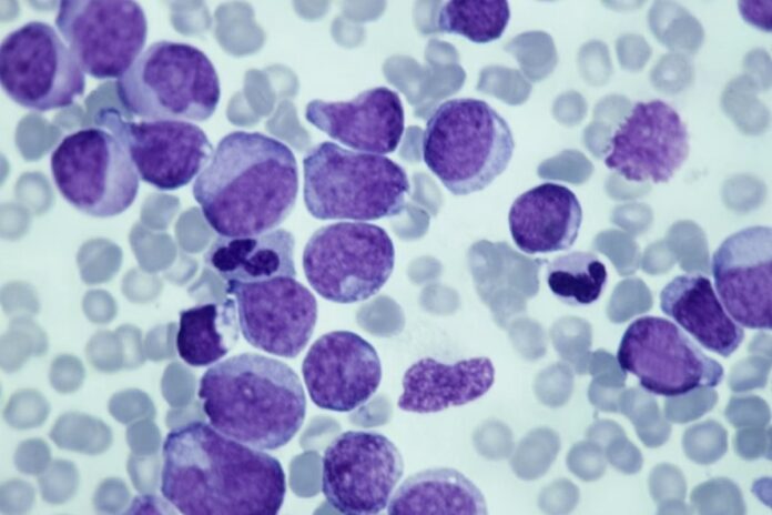 risco-de-cancer-comeca-a-aumentar-antes-do-nascimento,-sugere-estudo