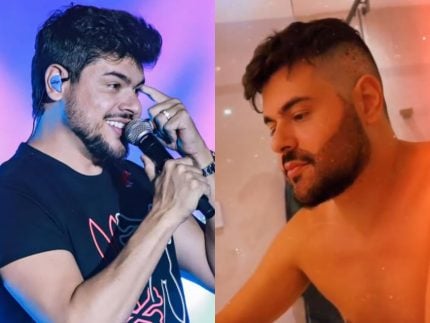 cristiano,-da-dupla-com-ze-neto,-exibe-resultado-do-implante-de-barba.-veja!