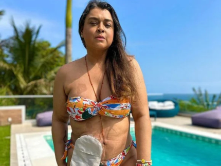 com-bolsa-de-colostomia-permanente,-como-sera-a-vida-de-preta-gil?-medico-responde