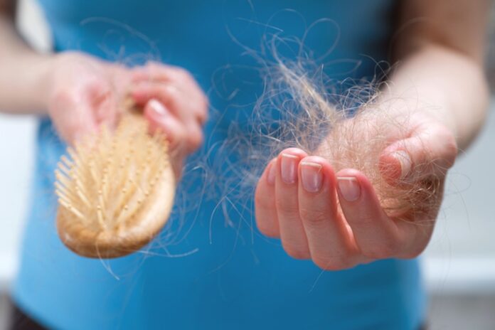 alopecia:-conheca-doenca-que-causa-queda-de-cabelo-feminina