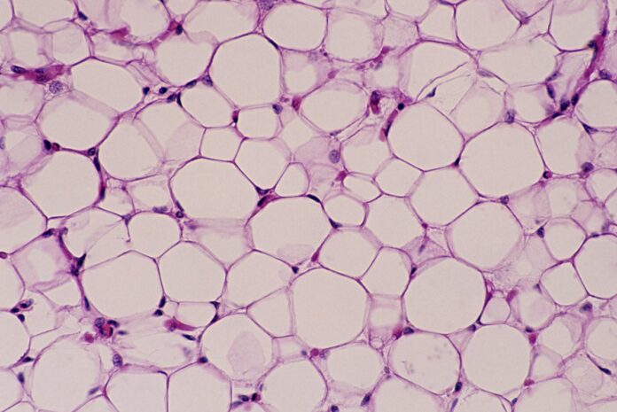 estudo-indica-que-celulas-de-gordura-marrom-podem-matar-as-de-cancer
