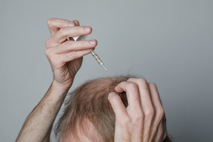 anvisa-determina-apreensao-de-minoxidil-sem-registro.-veja-lista
