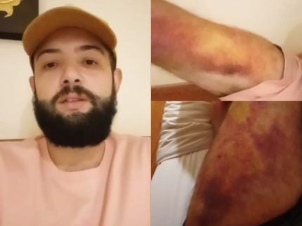 jovem-vitima-de-trafico-humano-revela-que-foi-torturado-para-enganar-brasileiros
