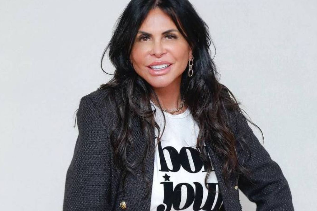 gretchen-mostra-antes-e-antes-de-tratamento-para-alopecia:-veja