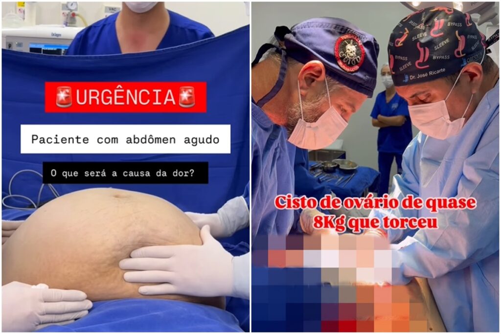 medico-retira-cisto-com-quase-8-kg-de-paciente-do-acre.-veja-video