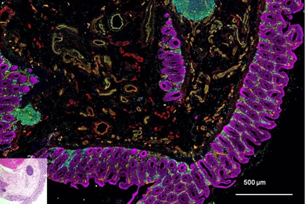 saude-do-coracao-depende-do-bem-estar-do-intestino.-entenda