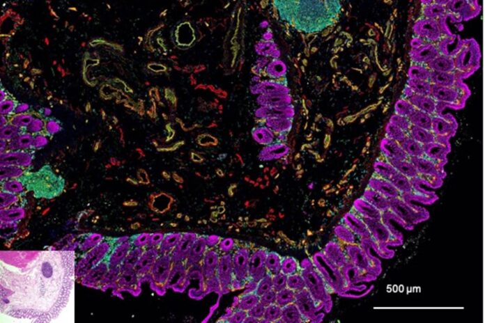 saude-do-coracao-depende-do-bem-estar-do-intestino.-entenda