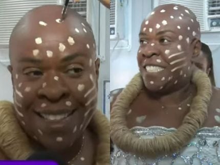 careca,-que-nada!-cacau-protasio-revela-truque-para-esconder-cabelo-na-fantasia