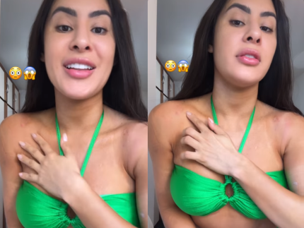 isabelle-nogueira-mostra-ferimentos-causados-por-fantasia-do-desfile-da-grande-rio