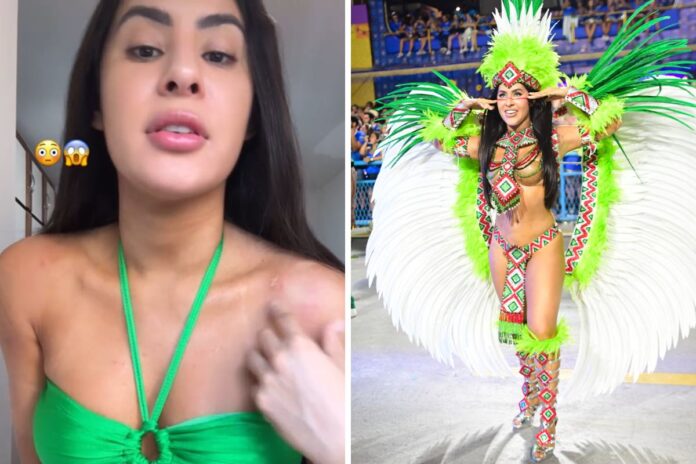 isabelle-nogueira-exibe-machucados-do-carnaval:-‘marcas-da-guerra’
