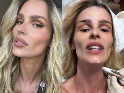yasmin-brunet-faz-procedimento-estetico-inspirado-em-rainha-egipcia;-entenda