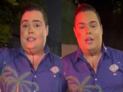 reporter-do-sbt-sofre-assalto-a-caminho-do-desfile-das-campeas e acaba ferido