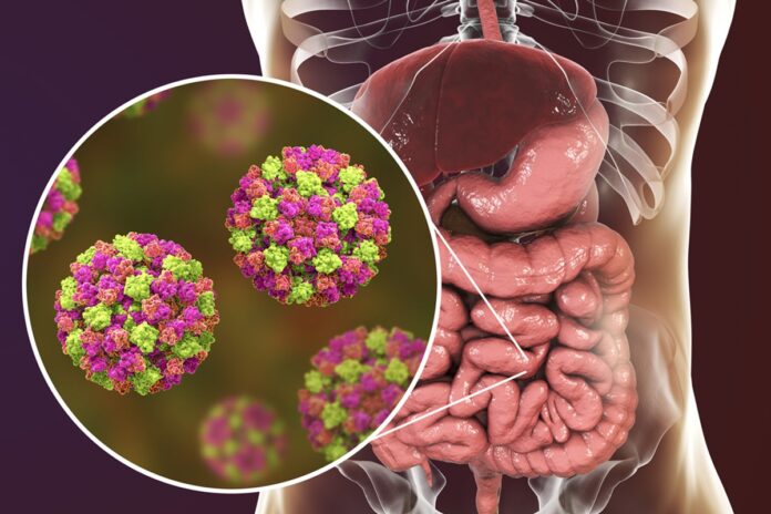 norovirus:-vacina-oral-apresenta-bons-resultados-em-testes-iniciais