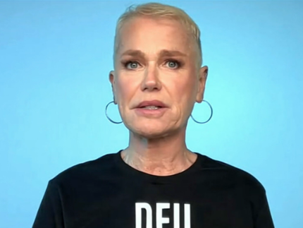 xuxa-faz-implante-capilar-e-sonha-voltar-a-usar-“xuquinhas-originais”