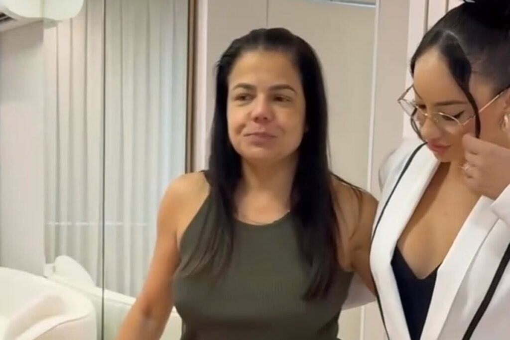 nivea-stelmann-faz-procedimento-para-“ficar-magra-sem-lipo”